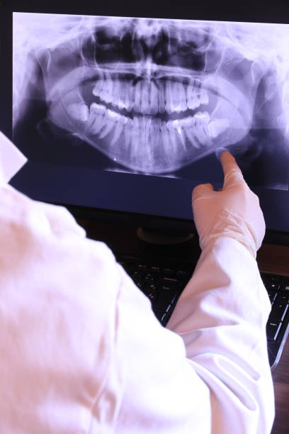 Best Emergency Wisdom Teeth Removal in Maytown, PA